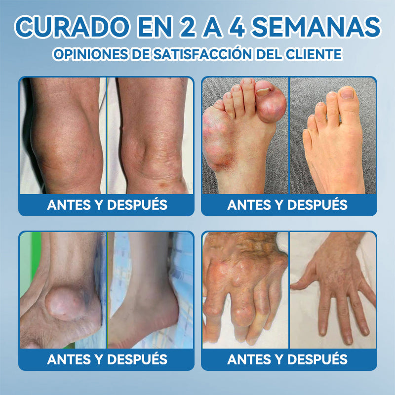 𝐓𝐢𝐞𝐧𝐝𝐚 𝐨𝐟𝐢𝐜𝐢𝐚𝐥 |🧨𝖯𝗂𝖼𝗱𝗼® 𝐵𝑃𝐶-157 𝐶𝑟𝑒𝑚𝑎 𝒅𝒆 𝑹𝒆𝒄𝒖𝒑𝒆𝒓𝒂𝒄𝒊ó𝒏 𝖠𝗋𝗍𝗂𝖼𝗎𝗅𝖺𝗋🦴𝑇𝑟𝑎𝑡𝑎 𝑙𝑎 𝑎𝑟𝑡𝑟𝑖𝑡𝑖𝑠, 𝑙𝑎 𝑛𝑒𝑢𝑟𝑜𝑝𝑎𝑡í𝑎, 𝑒𝑙 𝑟𝑒𝑢𝑚𝑎𝑡𝑖𝑠𝑚𝑜, 𝑙𝑎𝑠 𝑙𝑒𝑠𝑖𝑜𝑛𝑒𝑠 𝑑𝑒𝑝𝑜𝑟𝑡𝑖𝑣𝑎𝑠 𝑦 𝑚á𝑠.🧨