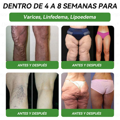 Tienda Oficial | 𝐃𝒊𝓪𝐩𝓪𝙨𝐨𝒏®🌼💖Ｇ𝖫𝑃-𝟏 𝑆𝑖𝑒𝑡𝑒 𝑒𝑛 𝑢𝑛𝑜 𝑆𝑜𝑙𝑢𝑐𝑖ó𝑛 𝑃𝑎𝑟𝑎 𝑙𝑎 𝑆𝑎𝑙𝑢𝑑 𝐿í𝑞𝑢𝑖𝑑𝑜 𝑂𝑟𝑎𝑙）(Solo una vez al día, cambios visibles en 7 días) Para obesidad, salud cardiovascular, diabetes, apnea del sueño, salud intestinal, problemas articulares y más