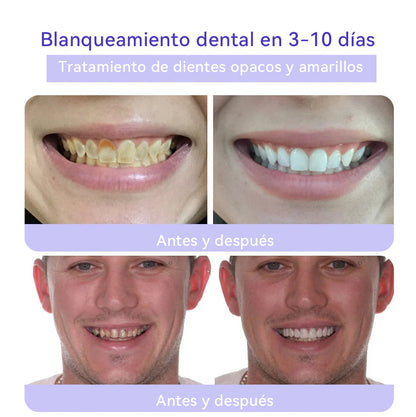 🔴𝐎𝐲𝐢𝐤𝐞𝐲®𝐃𝐢𝐞𝐧𝐭𝐞𝐬 𝐑𝐞𝐬𝐭𝐨𝐫𝐚 𝐓𝐢𝐨𝐧 𝐏𝐨𝐥𝐯𝐨 𝐌𝐢𝐧𝐞𝐫𝐚𝐥💋(CGD recomendado)