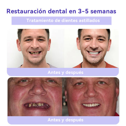 🔴𝐎𝐲𝐢𝐤𝐞𝐲®𝐃𝐢𝐞𝐧𝐭𝐞𝐬 𝐑𝐞𝐬𝐭𝐨𝐫𝐚 𝐓𝐢𝐨𝐧 𝐏𝐨𝐥𝐯𝐨 𝐌𝐢𝐧𝐞𝐫𝐚𝐥💋(CGD recomendado)