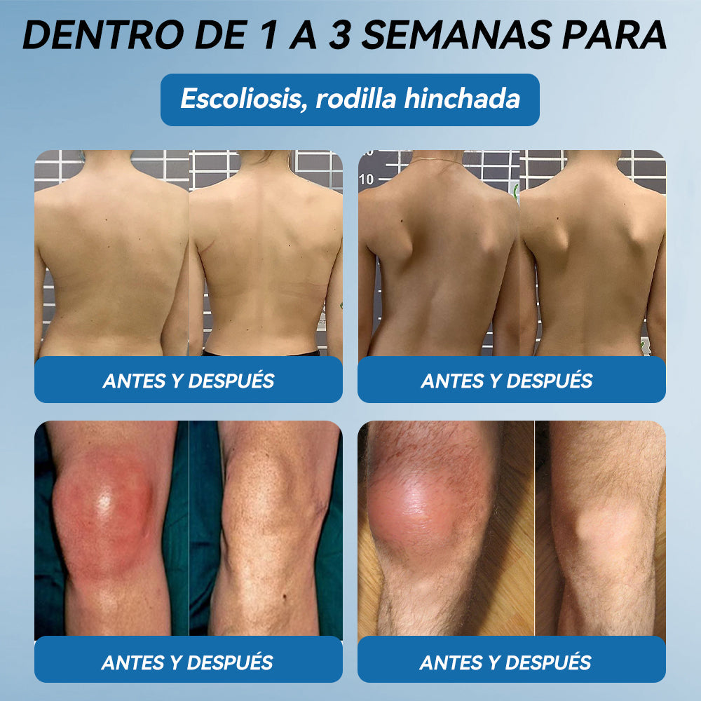 𝐓𝐢𝐞𝐧𝐝𝐚 𝐨𝐟𝐢𝐜𝐢𝐚𝐥 |🧨𝖯𝗂𝖼𝗱𝗼® 𝐵𝑃𝐶-157 𝐶𝑟𝑒𝑚𝑎 𝒅𝒆 𝑹𝒆𝒄𝒖𝒑𝒆𝒓𝒂𝒄𝒊ó𝒏 𝖠𝗋𝗍𝗂𝖼𝗎𝗅𝖺𝗋🦴𝑇𝑟𝑎𝑡𝑎 𝑙𝑎 𝑎𝑟𝑡𝑟𝑖𝑡𝑖𝑠, 𝑙𝑎 𝑛𝑒𝑢𝑟𝑜𝑝𝑎𝑡í𝑎, 𝑒𝑙 𝑟𝑒𝑢𝑚𝑎𝑡𝑖𝑠𝑚𝑜, 𝑙𝑎𝑠 𝑙𝑒𝑠𝑖𝑜𝑛𝑒𝑠 𝑑𝑒𝑝𝑜𝑟𝑡𝑖𝑣𝑎𝑠 𝑦 𝑚á𝑠.🧨