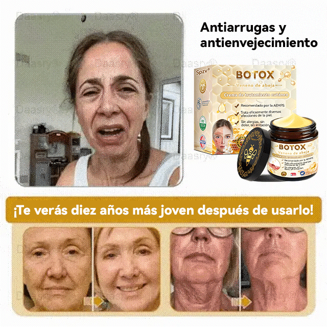 Universidad de Barcelona Oficial: 𝐒𝐩𝐳𝐯®𝐁𝐎𝐓𝐎𝐗 𝐕𝐞𝐧𝐞𝐧𝐨 𝐝𝐞 𝐚𝐛𝐞𝐣𝐚 𝐂𝐫𝐞𝐦𝐚 𝐝𝐞 𝐭𝐫𝐚𝐭𝐚𝐦𝐢𝐞𝐧𝐭𝐨 𝐜𝐮𝐭á𝐧𝐞𝐨, Hidratación, reparación de la piel, uniformización del tono, tratamiento del acné y manchas oscuras, eliminación de verrugas y lunares, alivio de la psoriasis